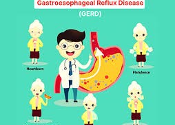 Living with Acid Reflux: Understanding and Managing Gastroesophageal Reflux Disease Living with Acid Reflux: Understanding and Managing Gastroesophageal Reflux Disease